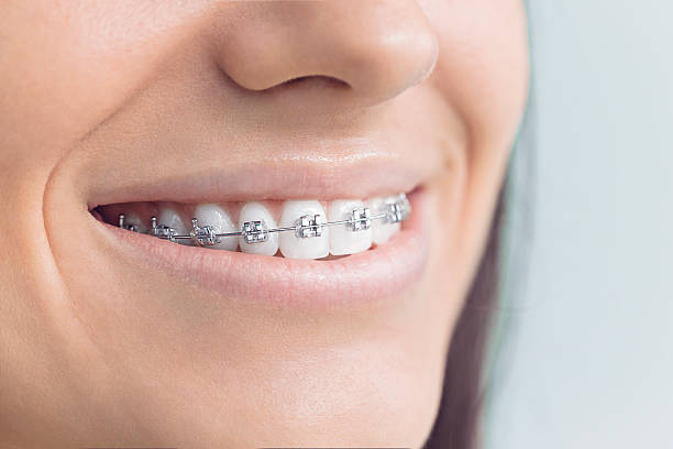 Best Full Mouth Reconstruction  in Pryor Creek, OK